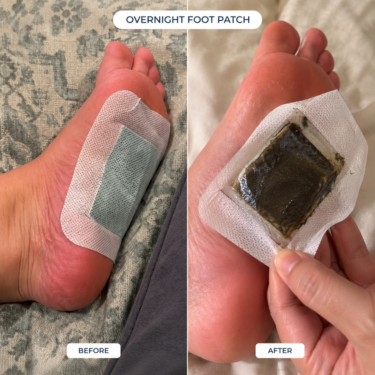 Nurtura Detox Foot Patches
