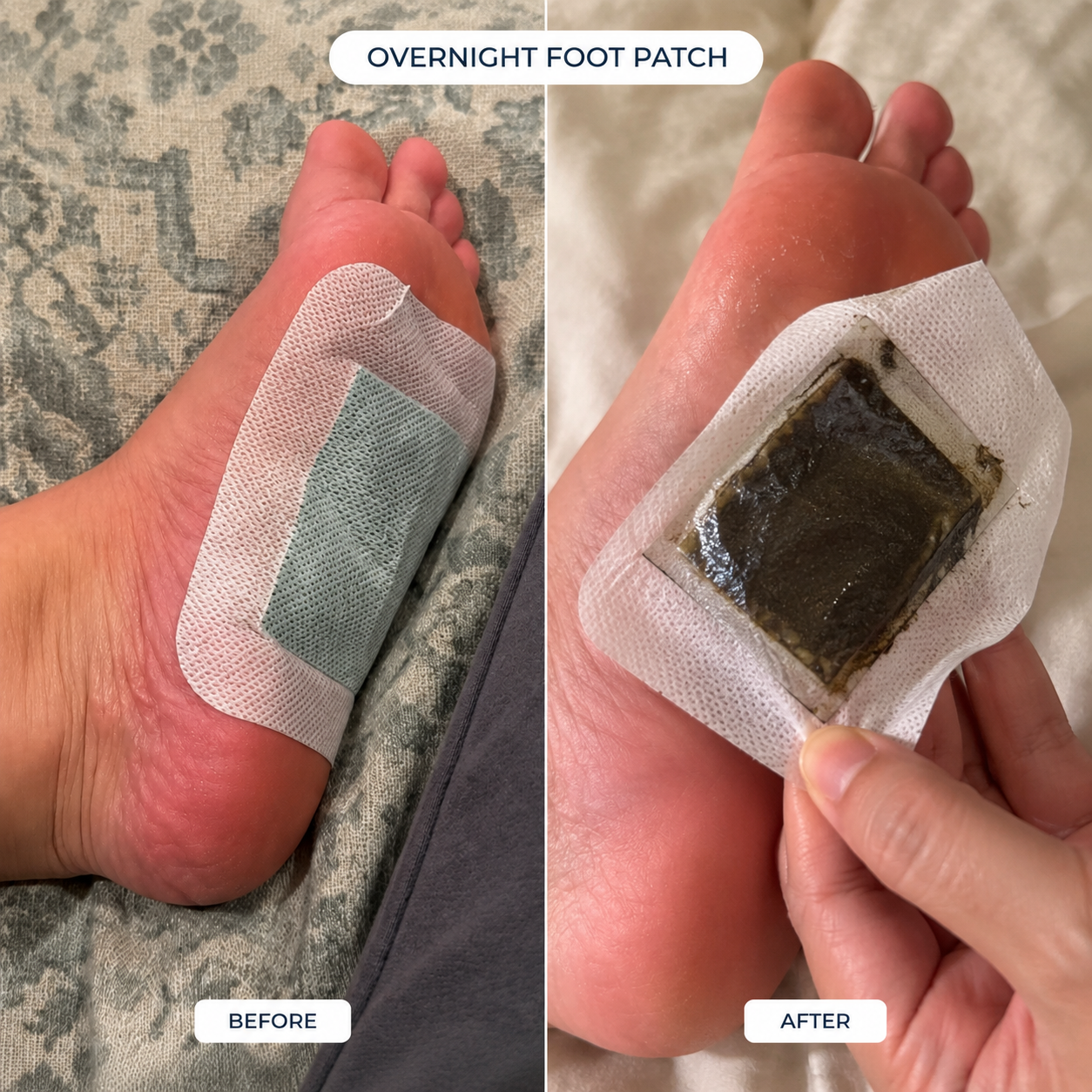 Nurtura Detox Foot Patches