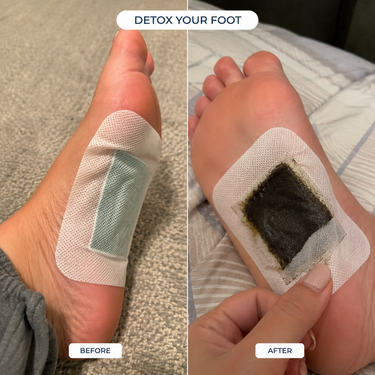 Nurtura Detox Foot Patches